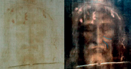 Linhas de expressão facial no Sudário de Turim. Foto: Scientia et Fides.